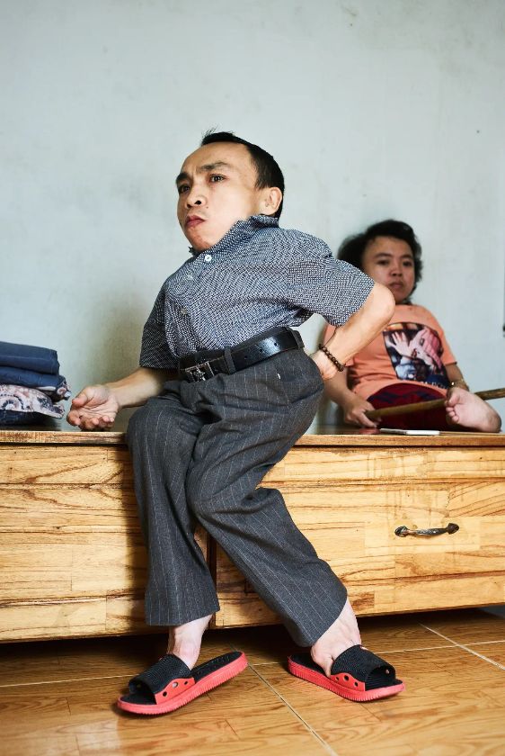 Nguyen Ngoc Phuong ist kleinwüchsig und lebt mit einer verkrümmten Wirbelsäule – {source?html}